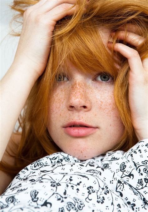 the MC1R gene. . Redhead freckles nude